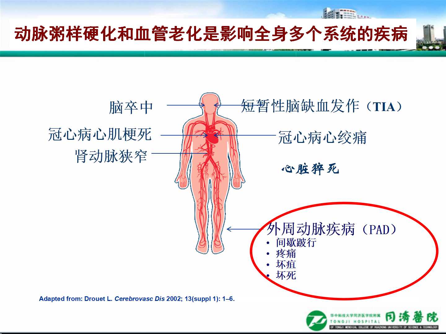 延缓血管损伤，加强慢病管理                 