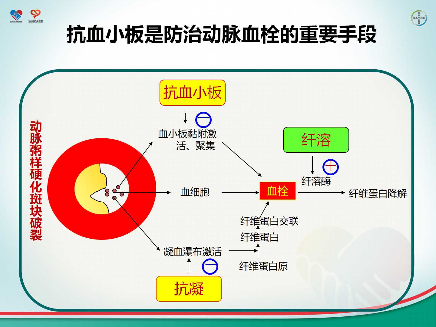 心血管疾病一级预防及危险因素的综合管理