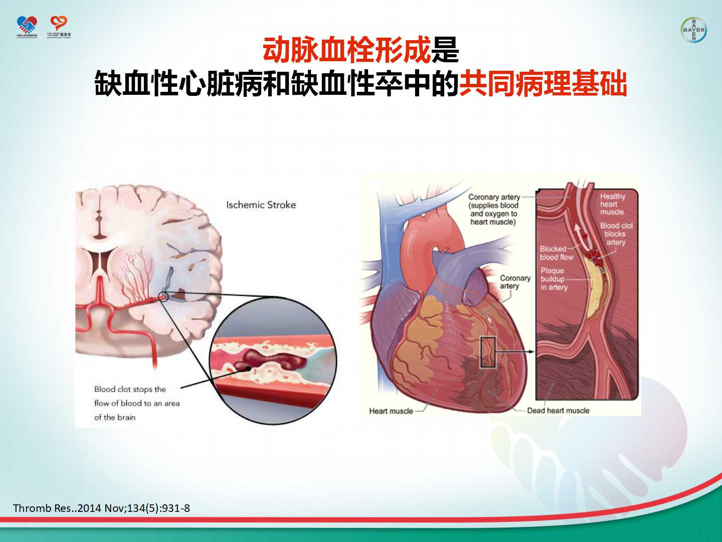 心血管疾病一级预防及危险因素的综合管理