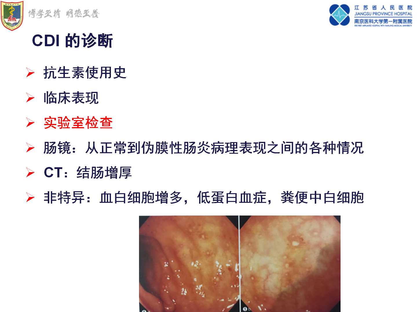 老年人抗生素相关性腹泻