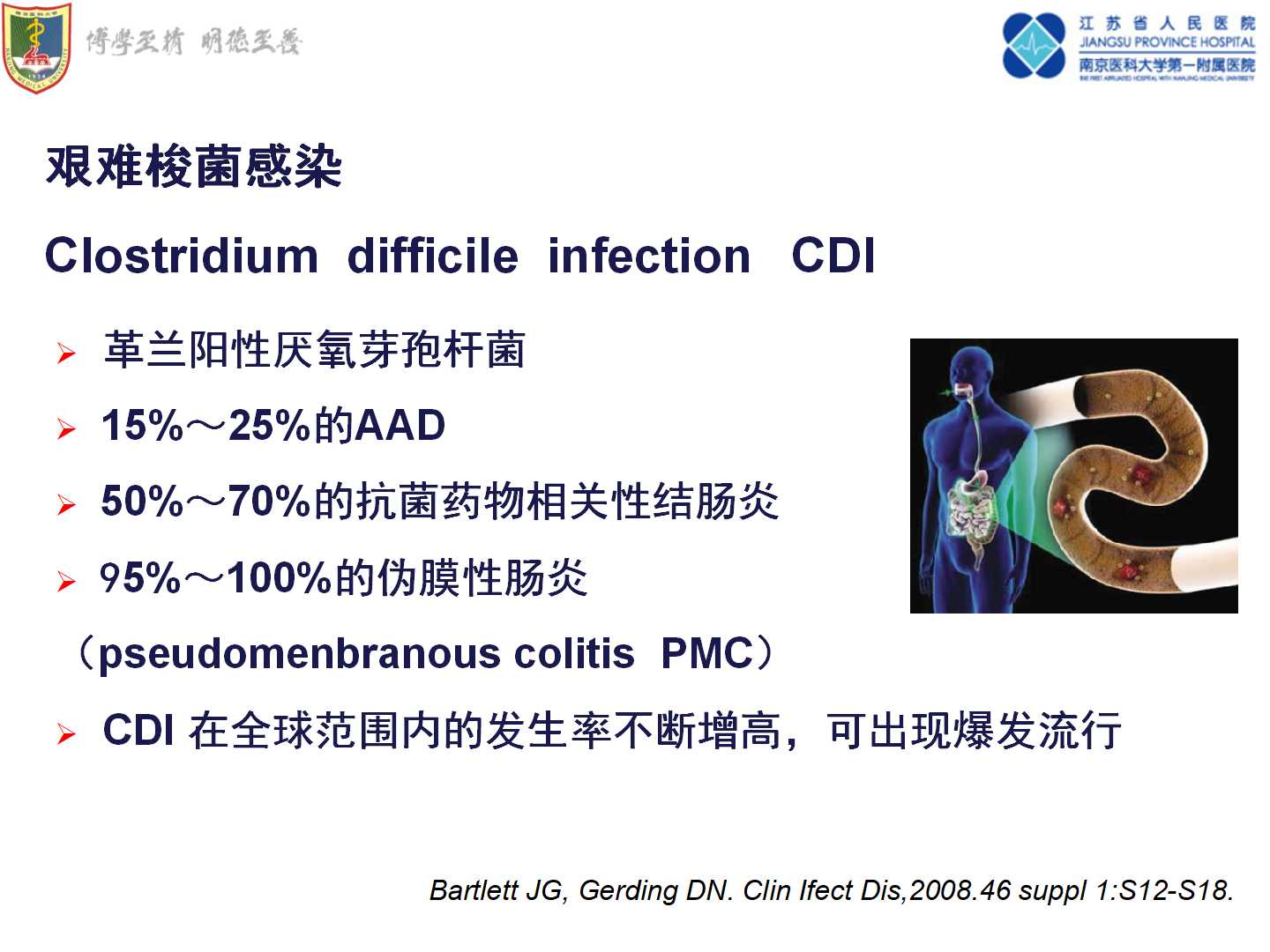 老年人抗生素相关性腹泻