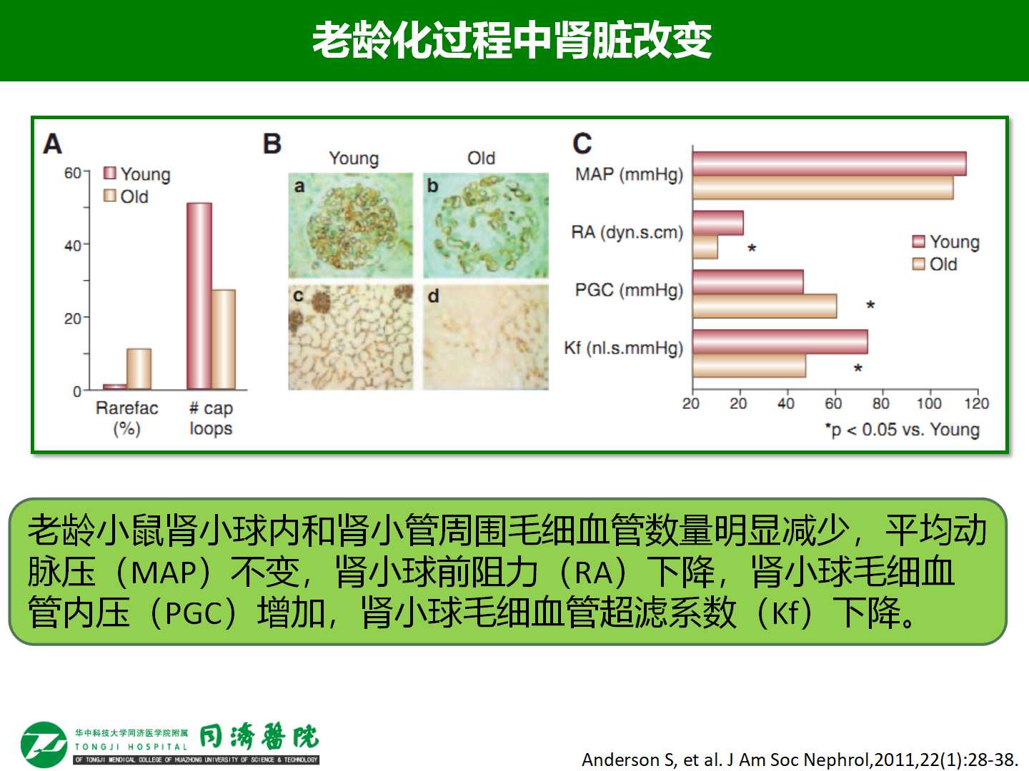 老年急性肾损伤的发病率和危险因素