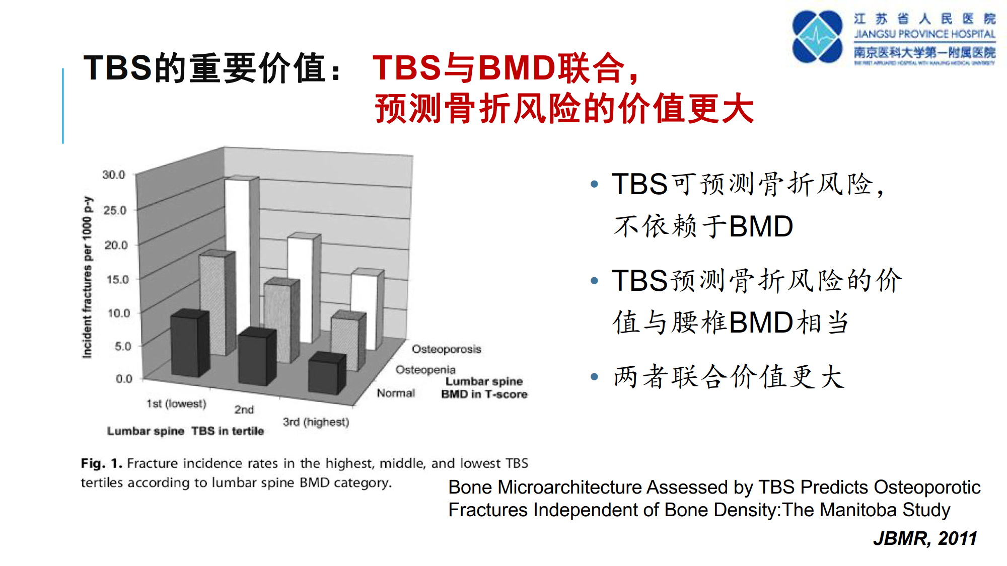 骨质疏松诊断新技术--TBS的临床应用