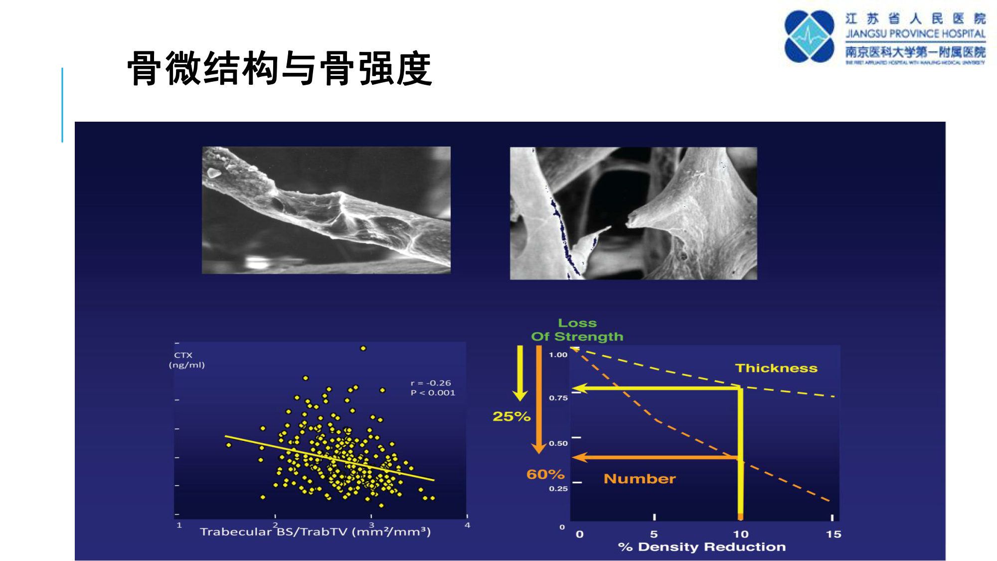 骨质疏松诊断新技术--TBS的临床应用