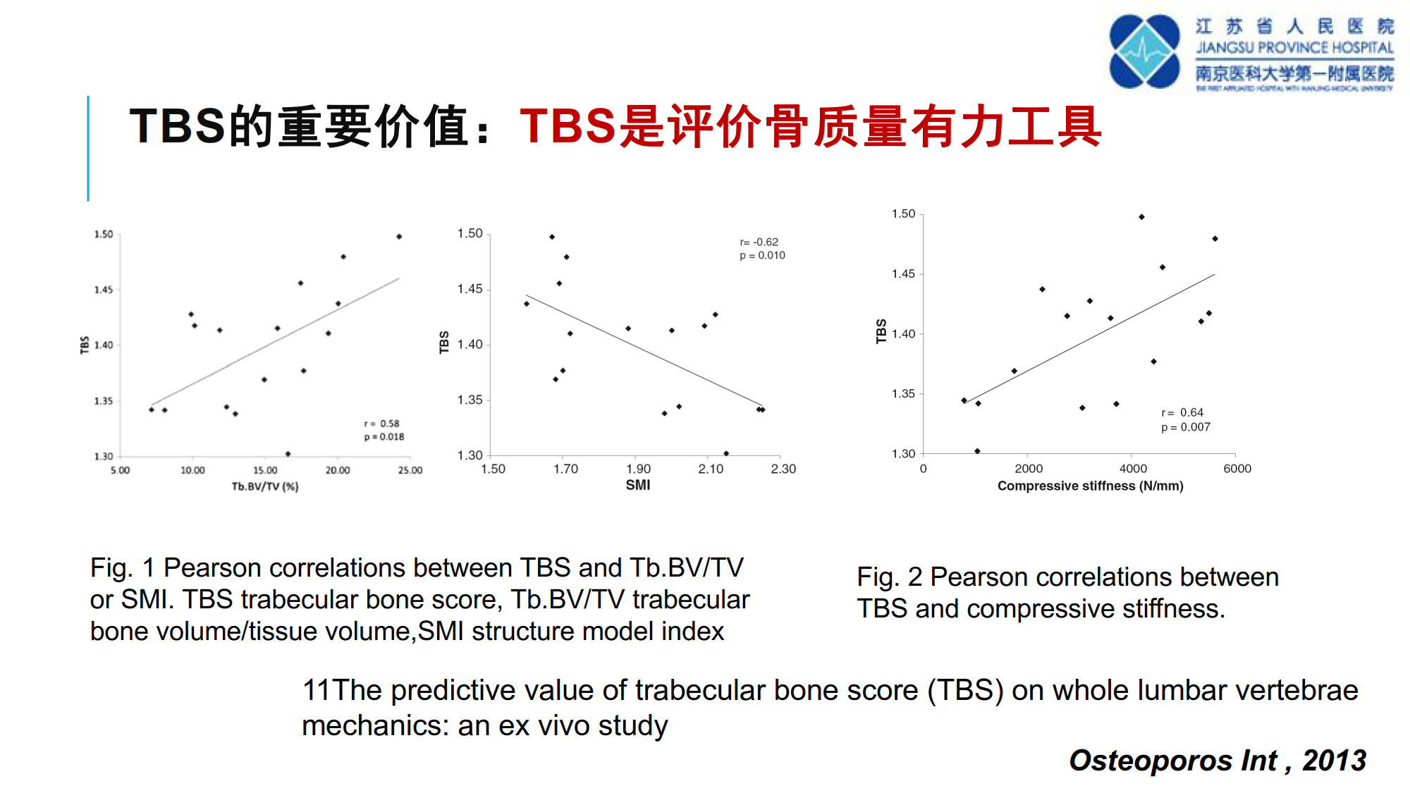 骨质疏松诊断新技术--TBS的临床应用