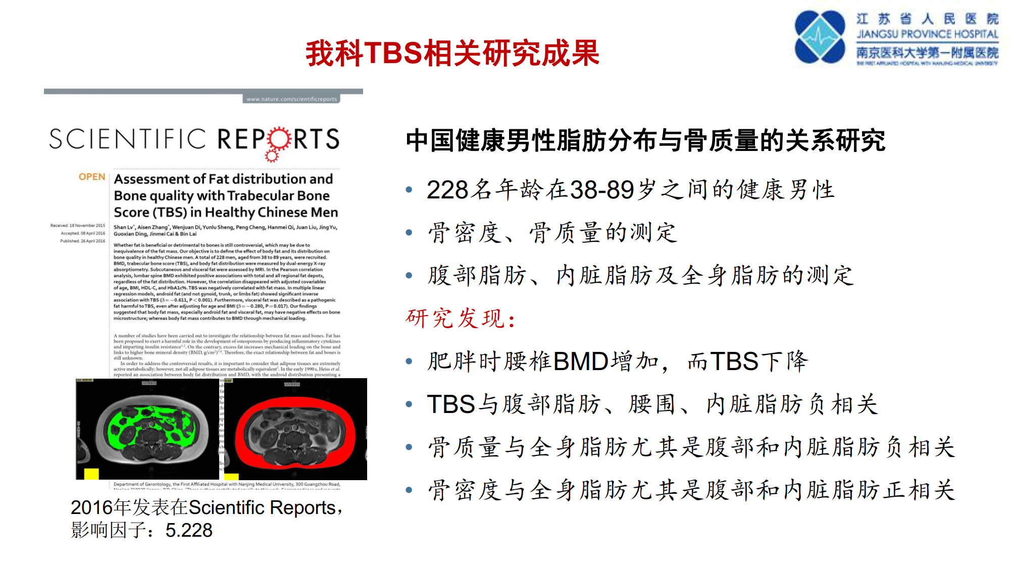 骨质疏松诊断新技术--TBS的临床应用