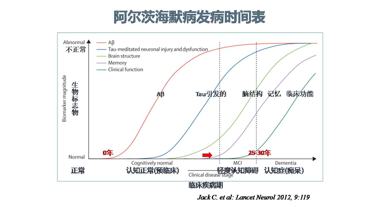 美国阿尔茨海默病研究现状与MemTrax应用