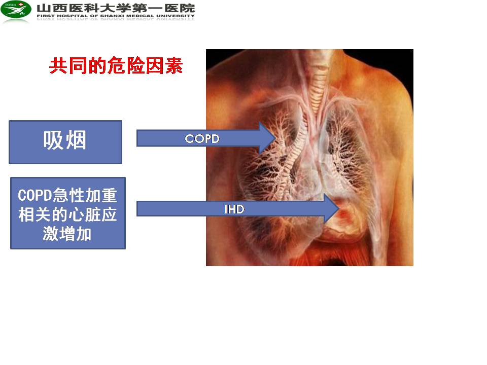 COPD与缺血性心脏病