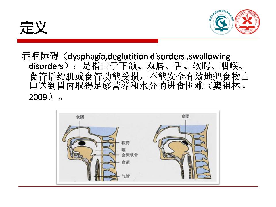 吞咽障碍与实践