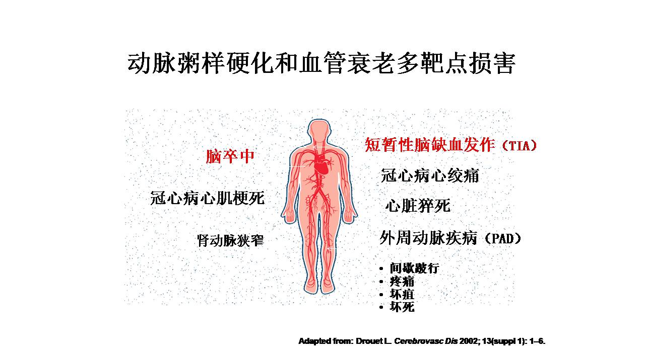 老年脑血管病的诊治