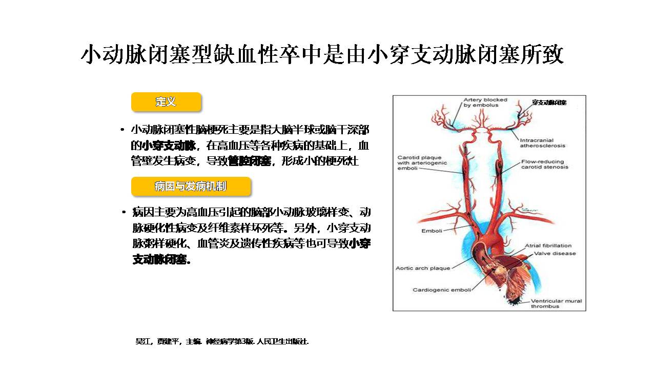 老年脑血管病的诊治