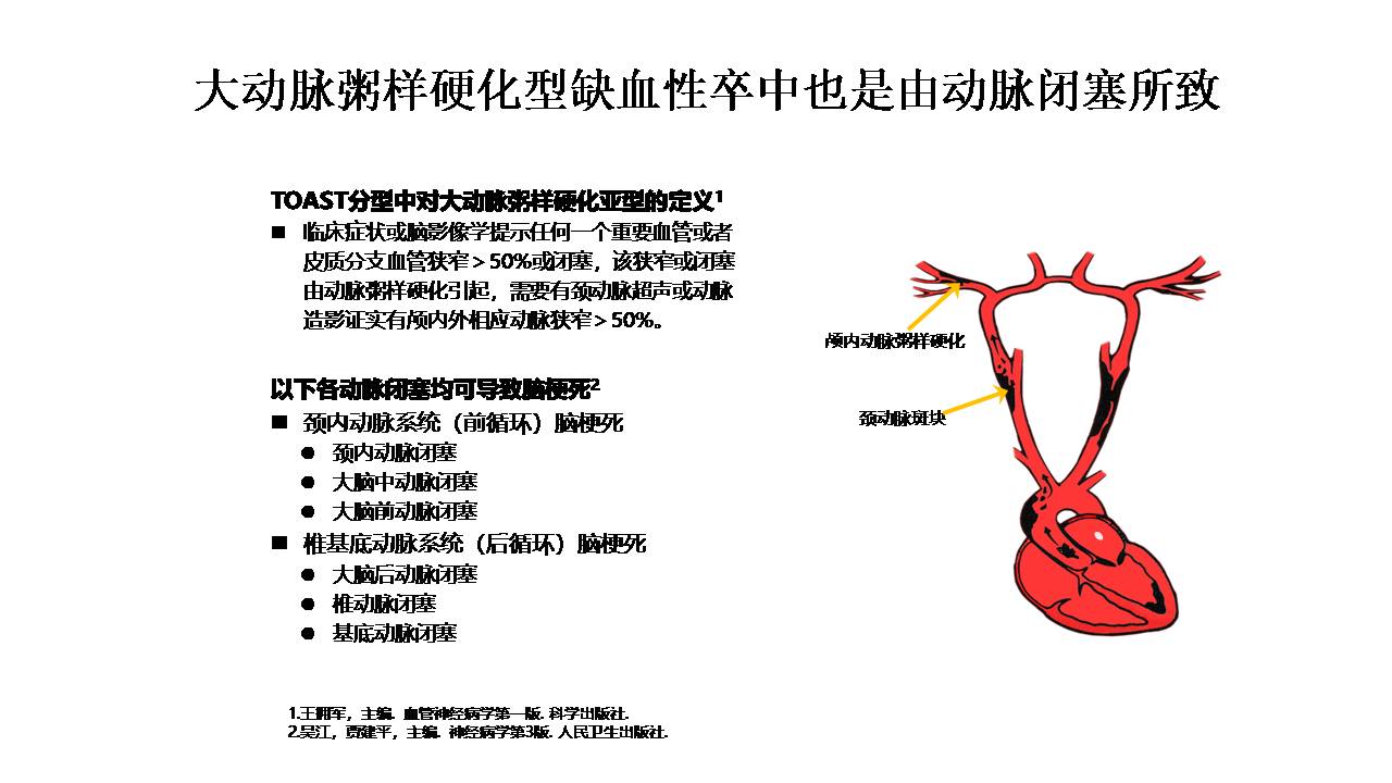 老年脑血管病的诊治