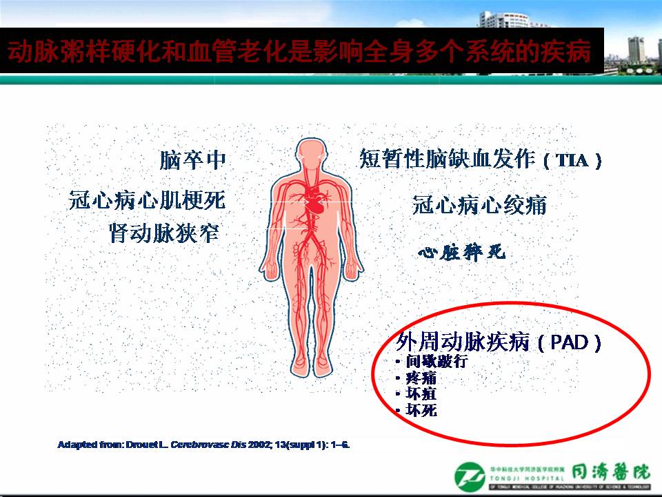 血管衰老临床评估与干预中国专家共识发布