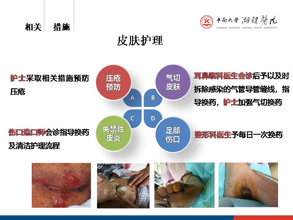 多学科合作促进老年重症患者康复