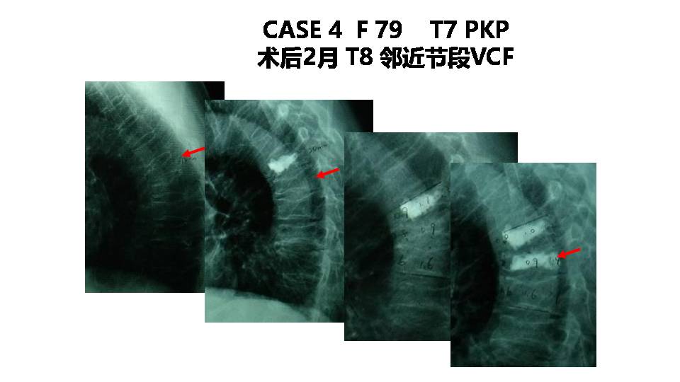 FLS系统在协和的修订试用