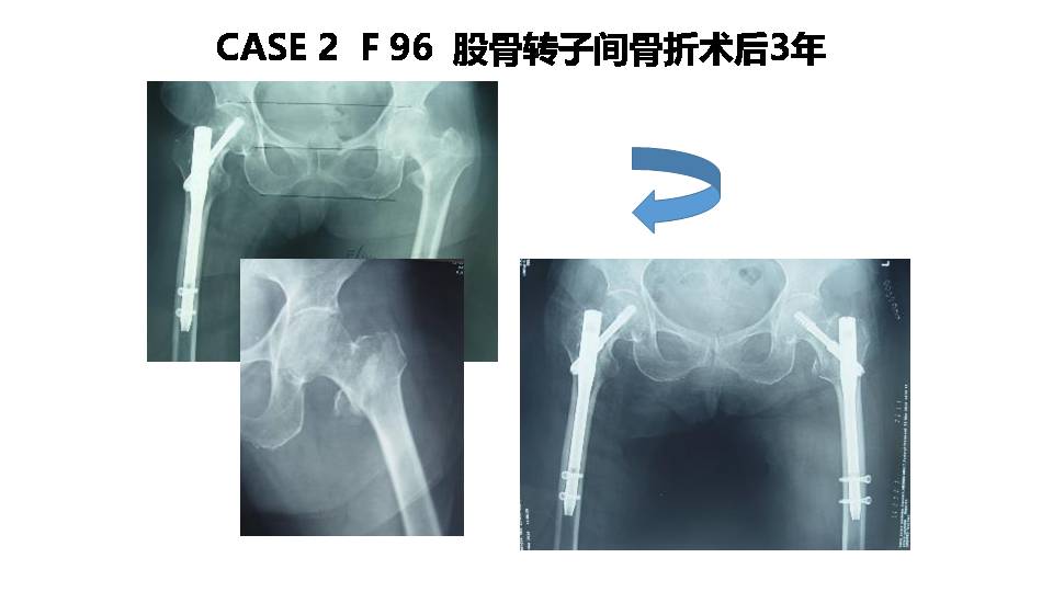 FLS系统在协和的修订试用