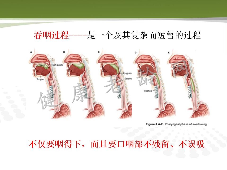 老年人消化道动力改变与临床