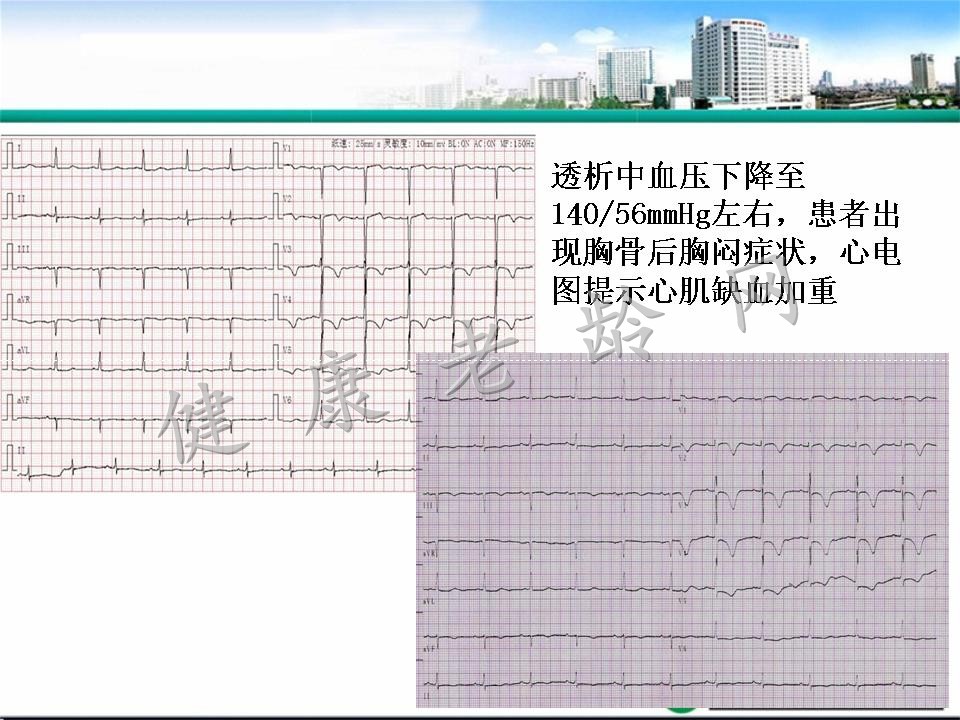 老年人多器官功能衰竭的诊治