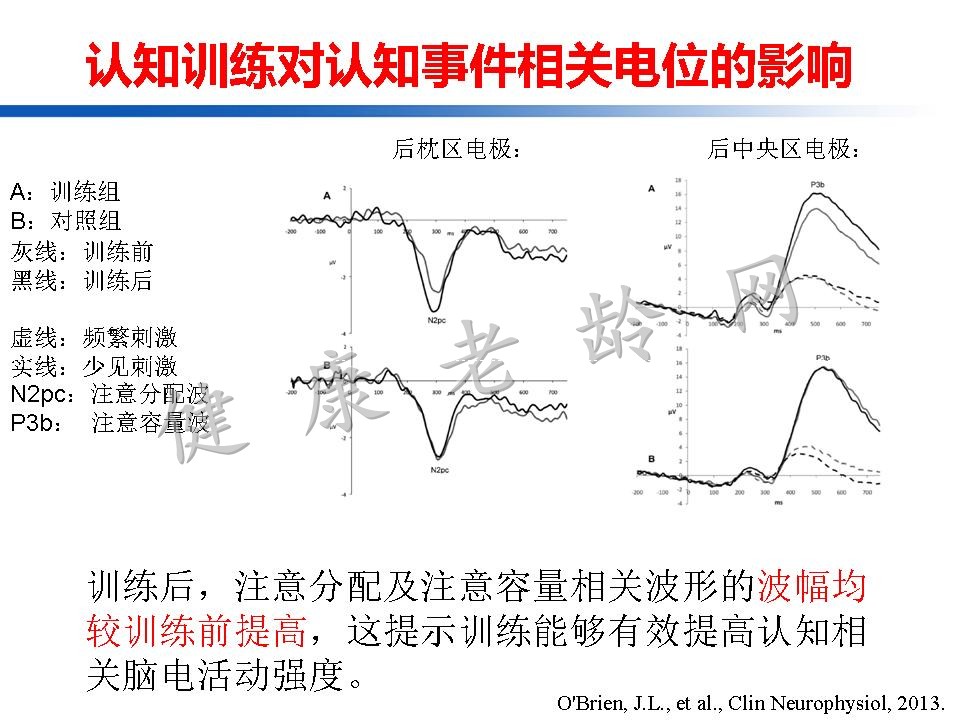 认知训练在认知障碍治疗中的作用：从临床到机制