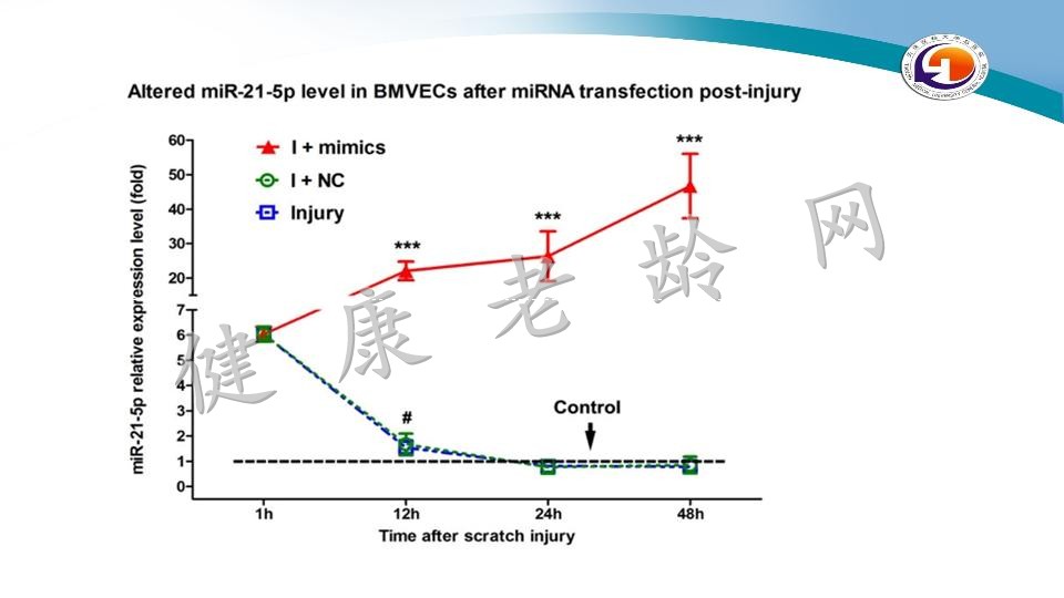 miR-21-5p通过抑制细胞凋亡和炎症来缓解受损大脑微血管内皮屏障的渗漏