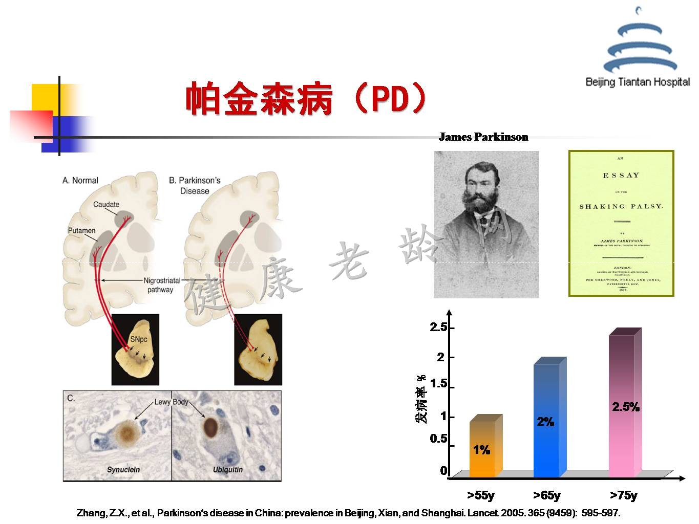 帕金森病铁代谢异常及其机制的研究