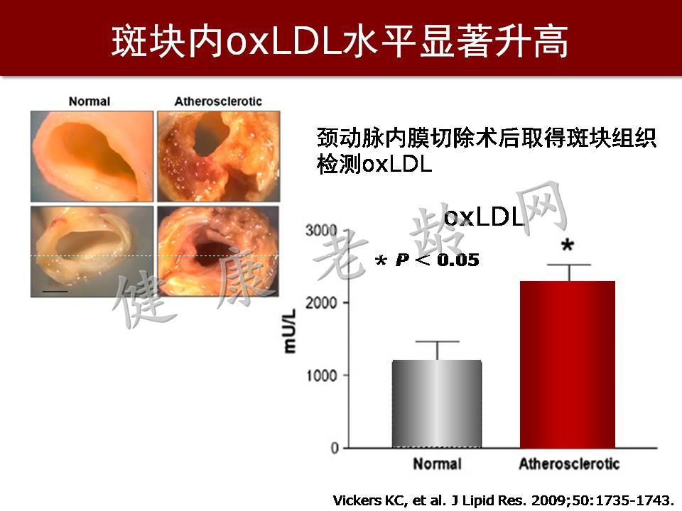 心脑血管疾病防治新策略——抗氧化应激