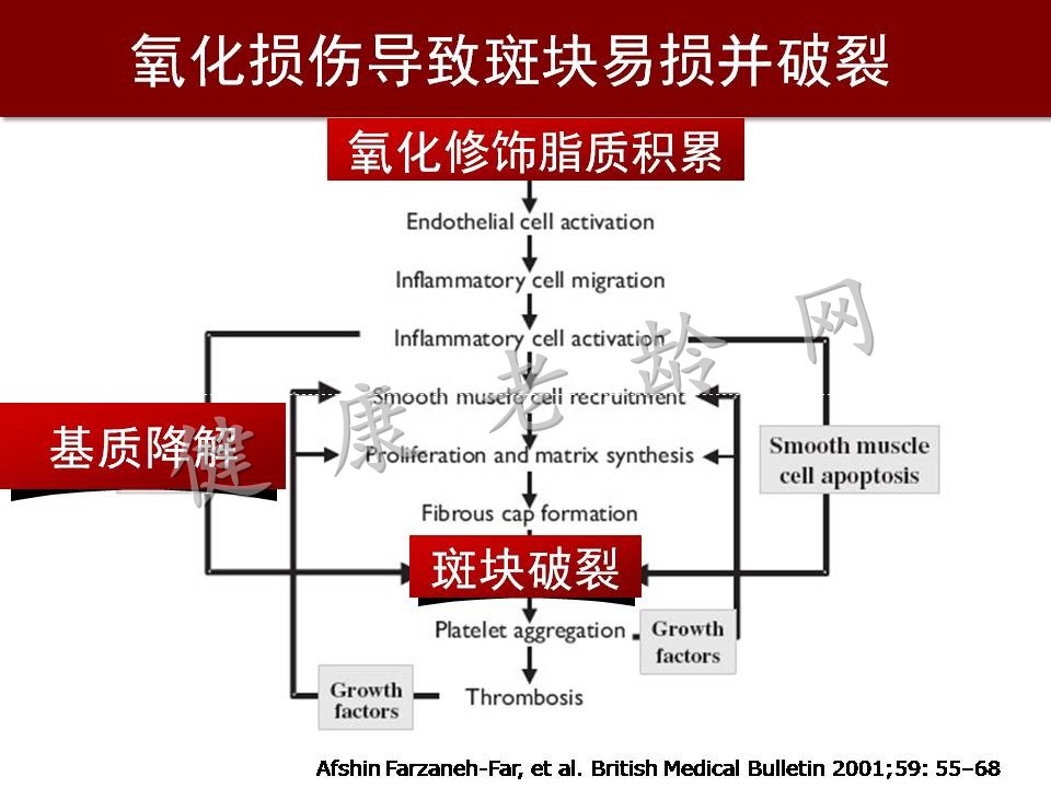 心脑血管疾病防治新策略——抗氧化应激