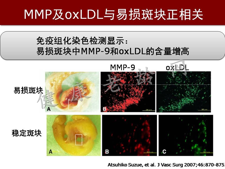 心脑血管疾病防治新策略——抗氧化应激