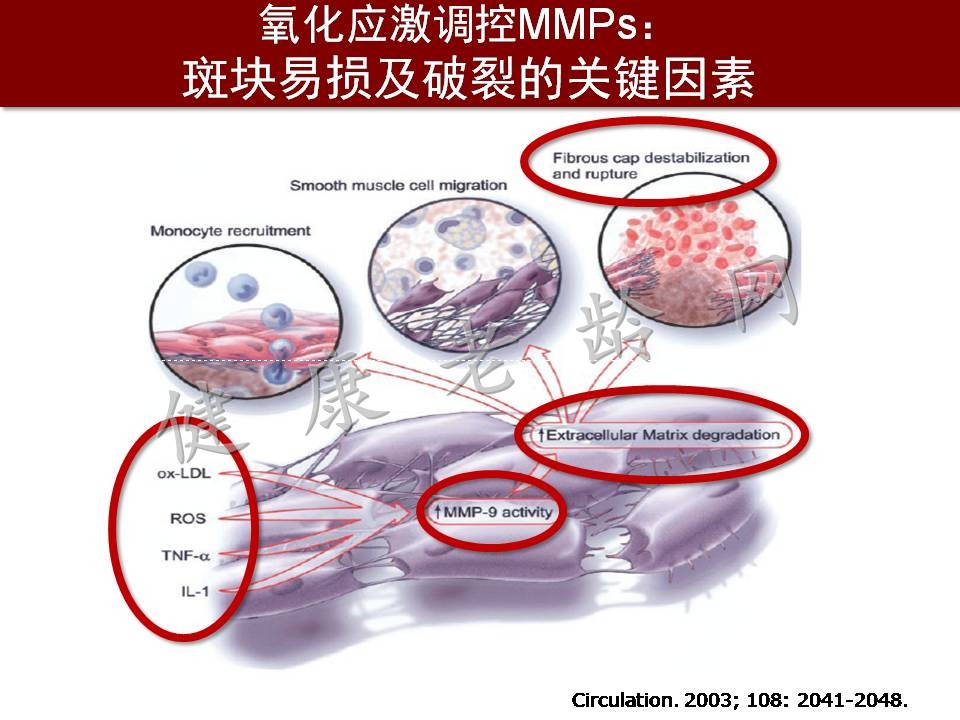 心脑血管疾病防治新策略——抗氧化应激