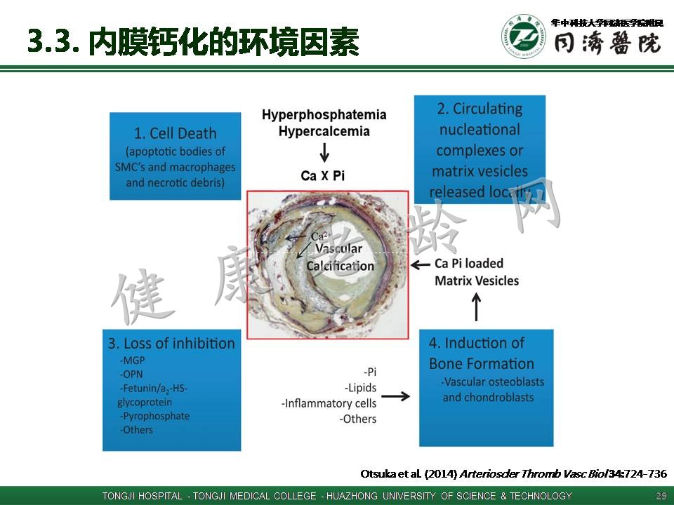 血管钙化与血管老化