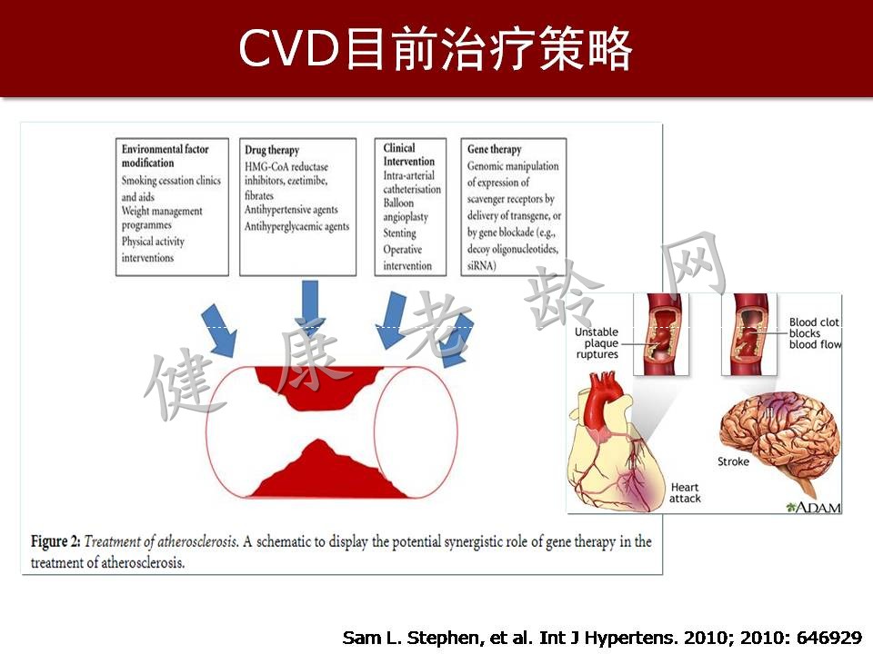 心脑血管疾病防治新策略——抗氧化应激