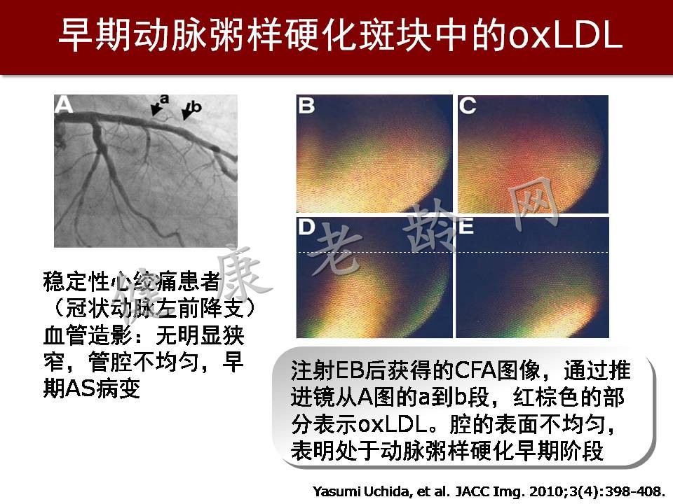 心脑血管疾病防治新策略——抗氧化应激