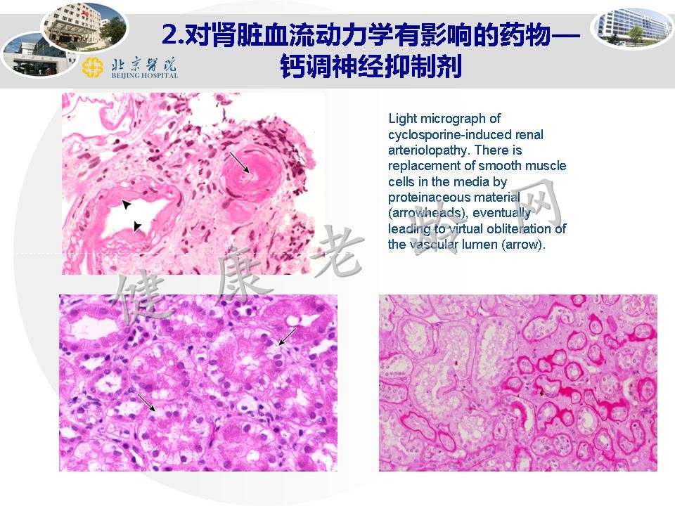 老年人药物性肾损害和药物相互作用