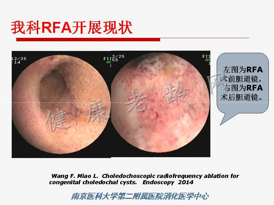 老年患者ERCP机遇与挑战