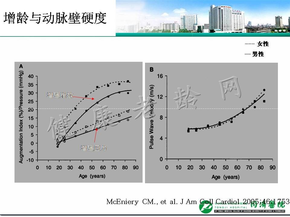 老年高血压与脉搏波传导速度