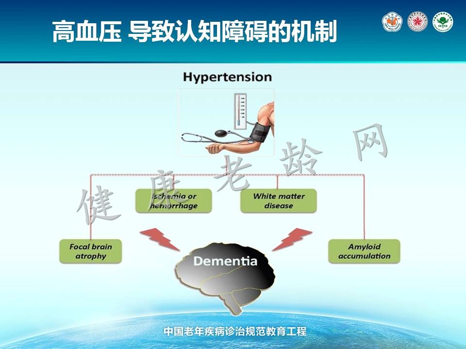 老年人认知障碍诊治规范