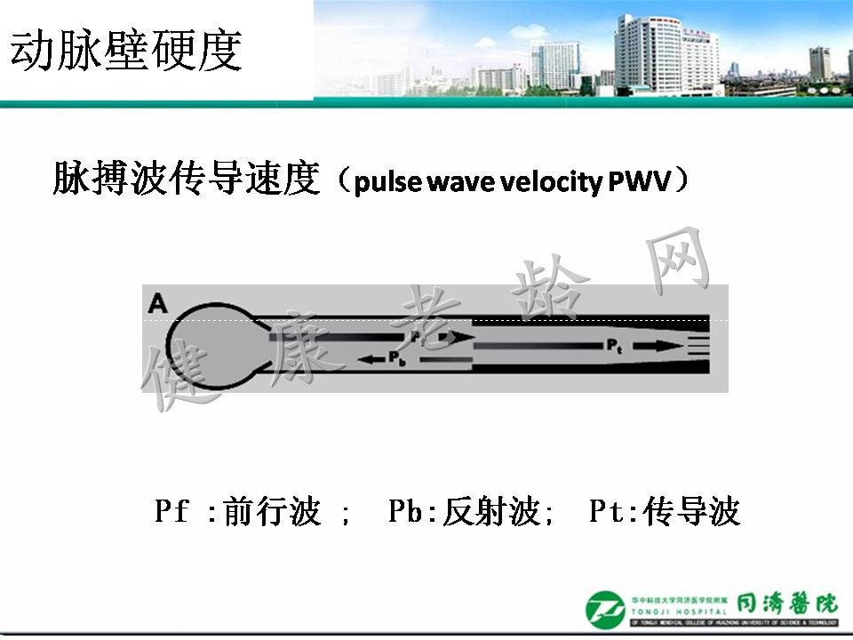 老年高血压与脉搏波传导速度