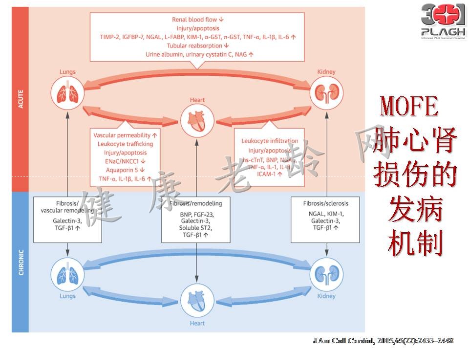 老年多器官衰竭的血液净化治疗