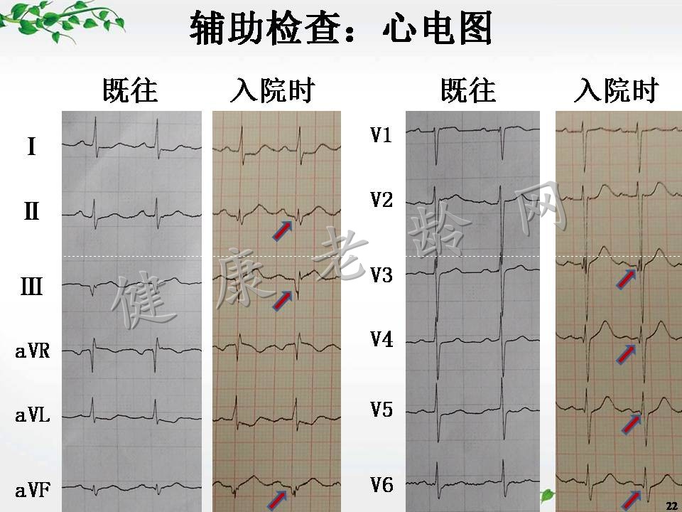 老年多病共存患者的综合管理