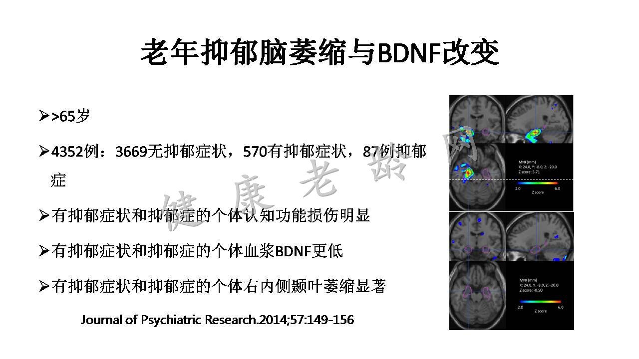 老年抑郁与认知功能障碍