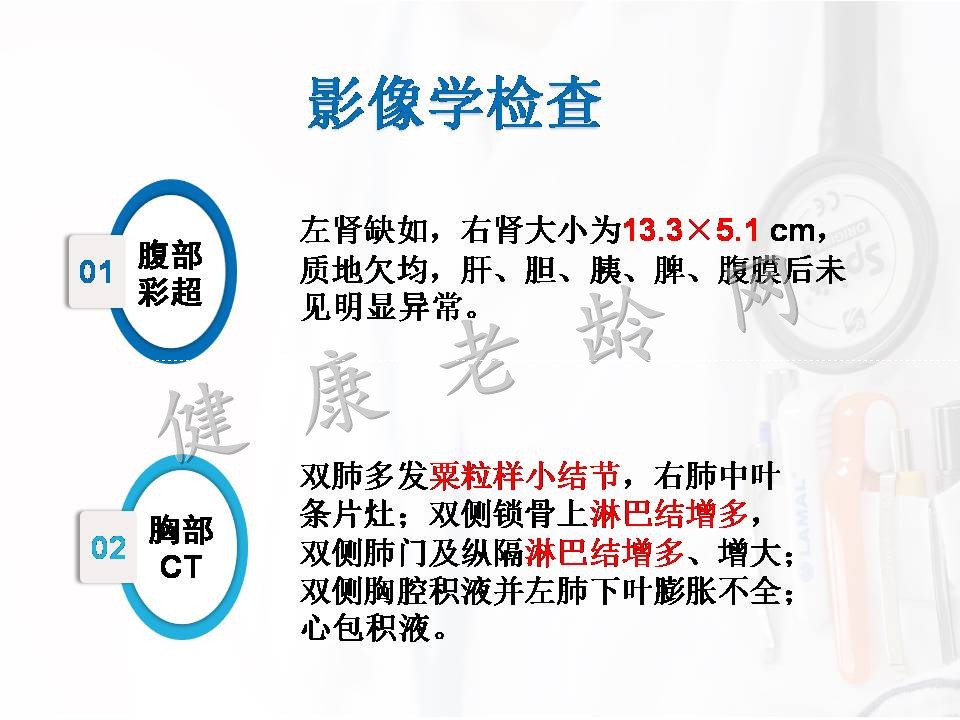 新的中老年自身免疫性疾病——lgG4相关性疾病肾损害的诊治