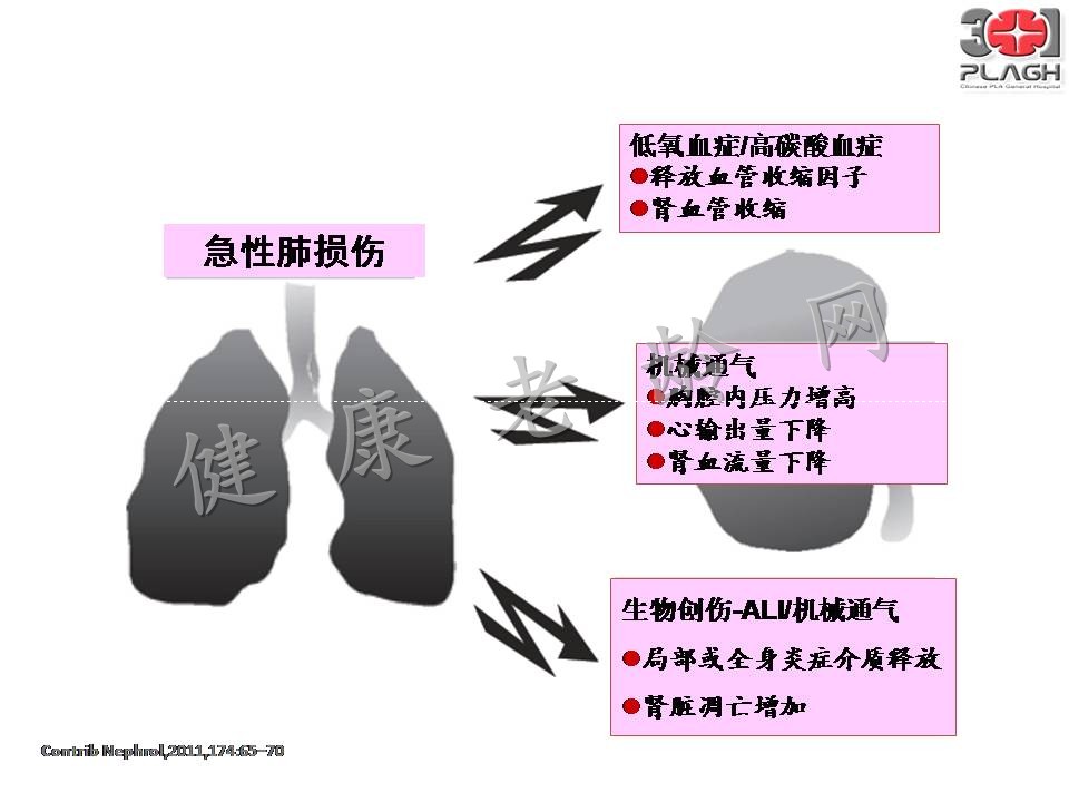 老年多器官衰竭的血液净化治疗