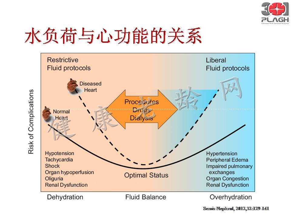 老年多器官衰竭的血液净化治疗