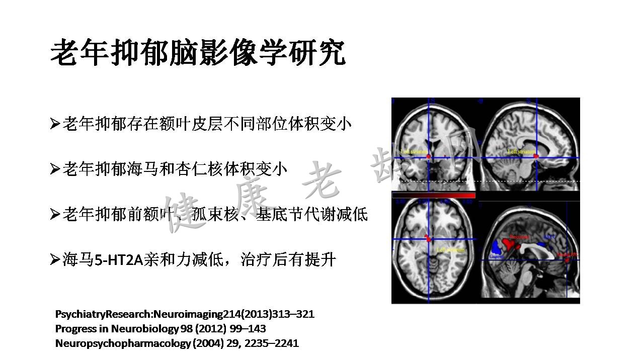 老年抑郁与认知功能障碍