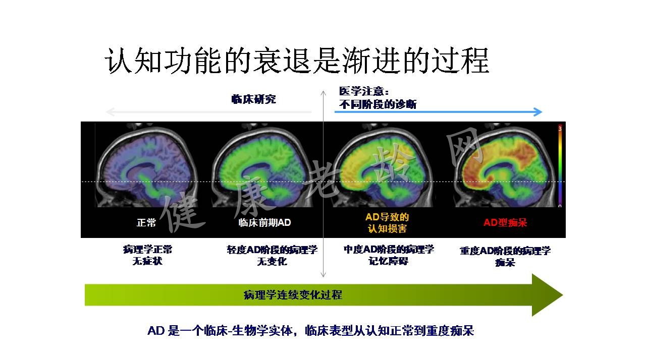 老年抑郁与认知功能障碍