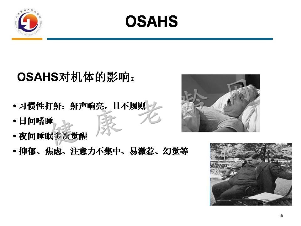 重视老年人OSAHS与认知障碍
