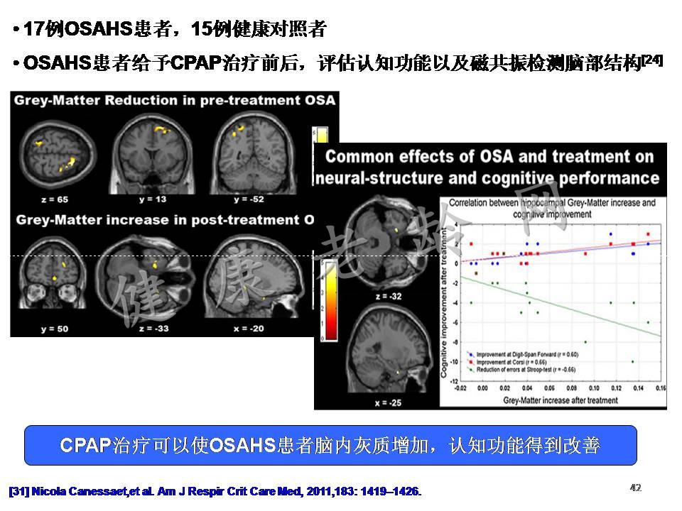 重视老年人OSAHS与认知障碍