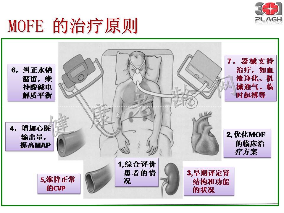 老年多器官衰竭的血液净化治疗