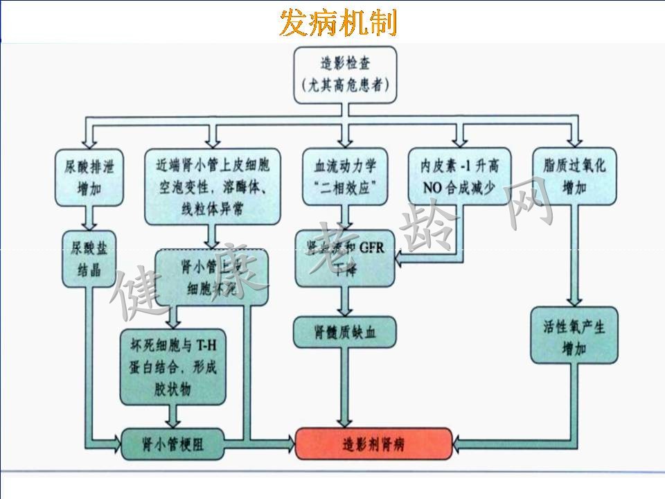 对比剂肾病