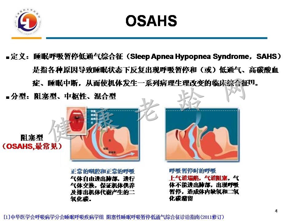 重视老年人OSAHS与认知障碍